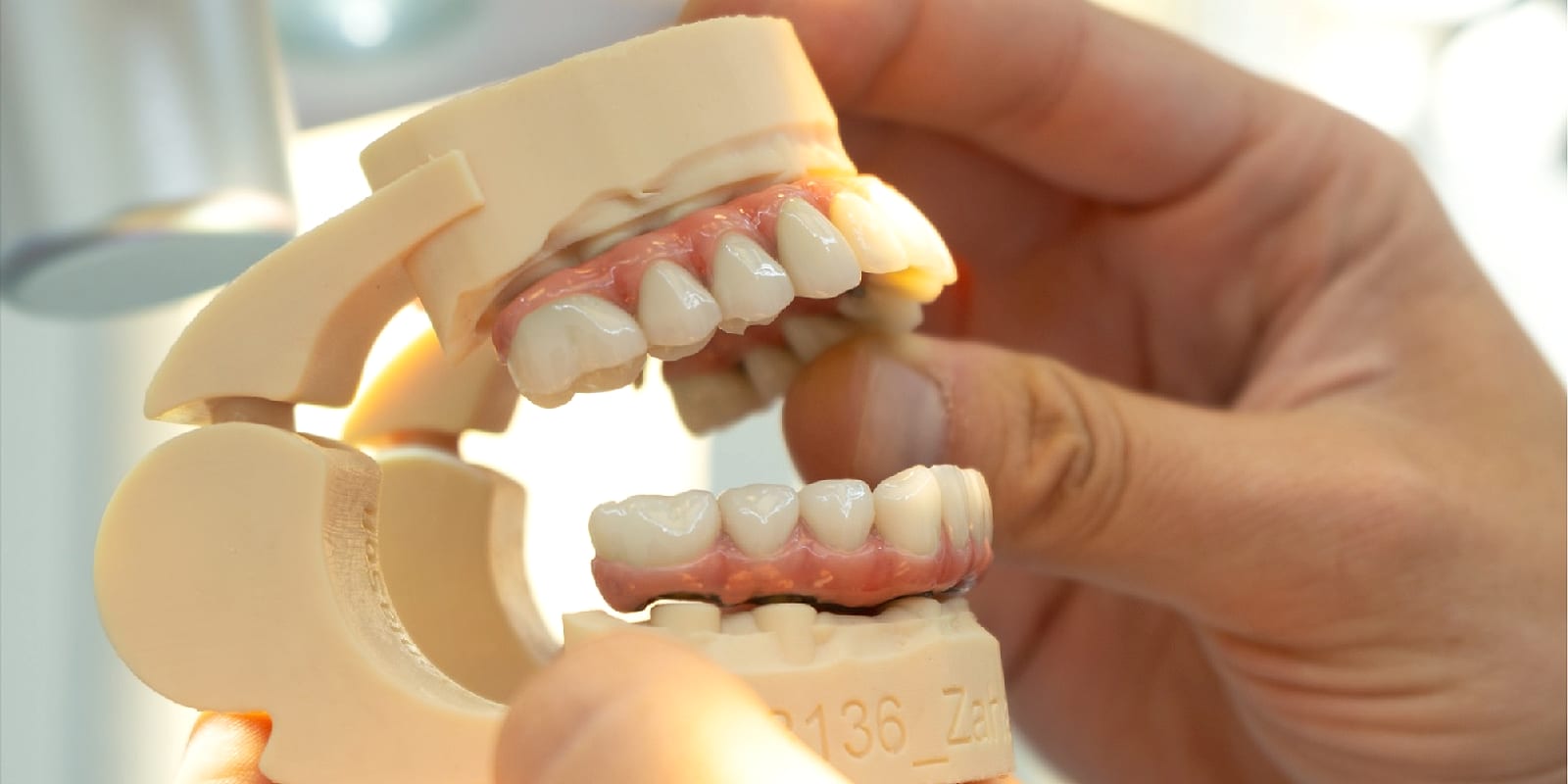 Lucrare protetică cu dinți ceramici, verificată pe modelul pacientului în laborator